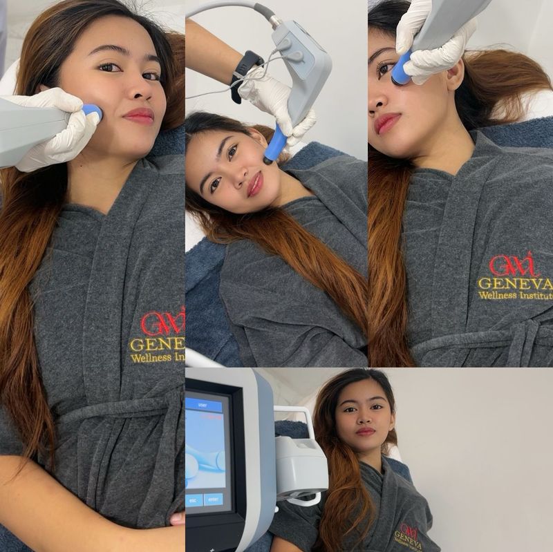 Exilis Face & Neck Treatment Exilis Face and Neck
